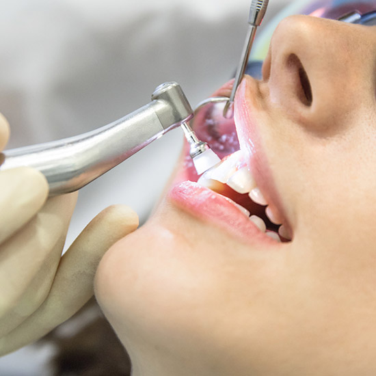 Odonto Integral - Prevencion - ¿Cual es el procedimiento para limpiar dientes?
