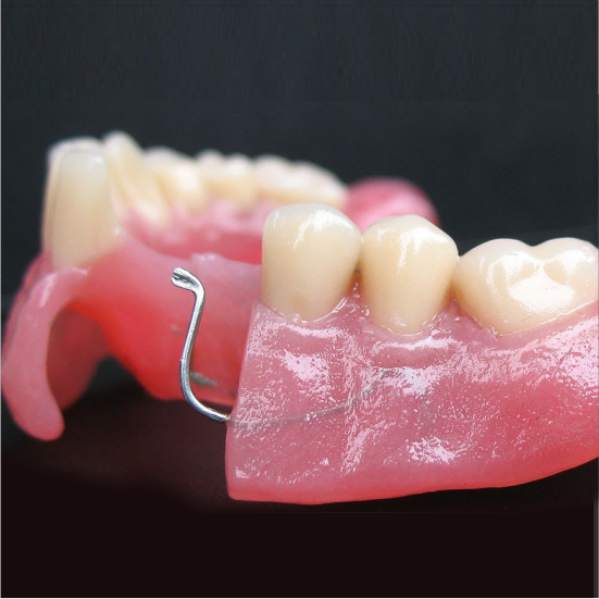 Odonto Integral - Protesis dental - Dentaduras parciales acrílicas